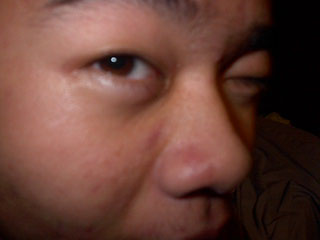 IM000358