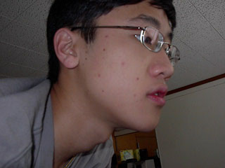 IM001549