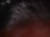 IM002695