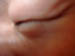 IM000386