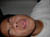 IM000152